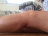 [Bonesmart.org] Good Strong Knee - No Bend<