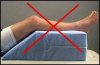 [Bonesmart.org] Partial Revision Failure