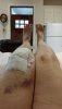 [Bonesmart.org] Partial Revision Failure
