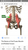 [Bonesmart.org] TKR September 10