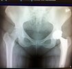[Bonesmart.org] On your side now!!