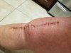 [Bonesmart.org] Oh my goodness the pain!