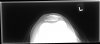 [Bonesmart.org] Instability Question