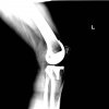 [Bonesmart.org] Instability Question