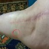 [Bonesmart.org] Revision #3 Journey
