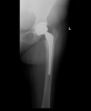 [Bonesmart.org] Trenna's recovery thread