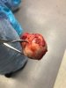 [Bonesmart.org] Jwadds Recovery (2 hip to be square!)