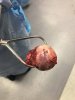 [Bonesmart.org] Jwadds Recovery (2 hip to be square!)