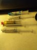 [Bonesmart.org] Right TKR revision from staph infection<