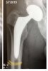 [Bonesmart.org] Another Second Chance