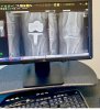 [Bonesmart.org] Update