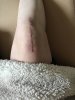 [Bonesmart.org] Irish471's Recovery Thread