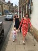 [Bonesmart.org] Bickypeg's new hip