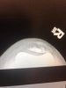 [Bonesmart.org] Third times the charm- hopefully