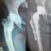 [Bonesmart.org] Icespirit5 Recovery Thread