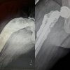 [Bonesmart.org] Icespirit5 Recovery Thread