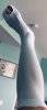[Bonesmart.org] bye-bye femoral head! my post-op recovery thread