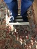 [Bonesmart.org] Total Ankle Replacement Journey