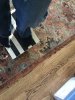[Bonesmart.org] Total Ankle Replacement Journey