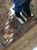 [Bonesmart.org] Total Ankle Replacement Journey