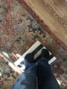 [Bonesmart.org] Total Ankle Replacement Journey