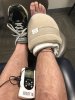 [Bonesmart.org] Total Ankle Replacement Journey