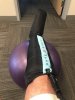 [Bonesmart.org] Total Ankle Replacement Journey