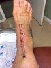 [Bonesmart.org] Total Ankle Replacement 9-12-19