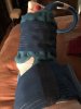 [Bonesmart.org] Total Ankle Replacement 9-12-19