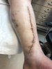 [Bonesmart.org] Millie's recovery thread