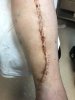 [Bonesmart.org] Millie's recovery thread