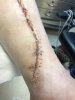 [Bonesmart.org] Millie's recovery thread