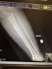 [Bonesmart.org] Millie's recovery thread