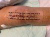 [Bonesmart.org] Knee Scars - Post Your Badges of Honor Here! NO CHIT-CHAT please