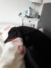 [Bonesmart.org] One Year Post Surgery