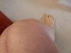 [Bonesmart.org] Grandma Chris gets a new knee!