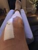 [Bonesmart.org] Knee Scars - Post Your Badges of Honor Here! NO CHIT-CHAT please