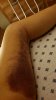 [Bonesmart.org] Makoplasty: ongoing pain<