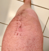 Swelling.png Swelling.png