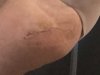 [Bonesmart.org] Hippies scars - post your badges of honor here: NO CHIT-CHAT HERE PLEASE