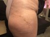 [Bonesmart.org] Hippies scars - post your badges of honor here: NO CHIT-CHAT HERE PLEASE