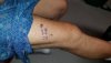 [Bonesmart.org] Knee Scars - Post Your Badges of Honor Here! NO CHIT-CHAT please