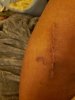 [Bonesmart.org] Hippies scars - post your badges of honor here: NO CHIT-CHAT HERE PLEASE