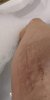 [Bonesmart.org] Hippies scars - post your badges of honor here: NO CHIT-CHAT HERE PLEASE