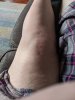 [Bonesmart.org] Revision