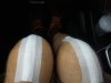 [Bonesmart.org] Knee Scars - Post Your Badges of Honor Here! NO CHIT-CHAT please