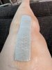 [Bonesmart.org] Knee Scars - Post Your Badges of Honor Here! NO CHIT-CHAT please