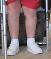 [Bonesmart.org] Chugging Down the Track to Recovery