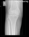 [Bonesmart.org] It's been a long time.....