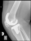 [Bonesmart.org] It's been a long time.....